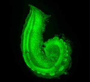 abnormal mouse cochlea