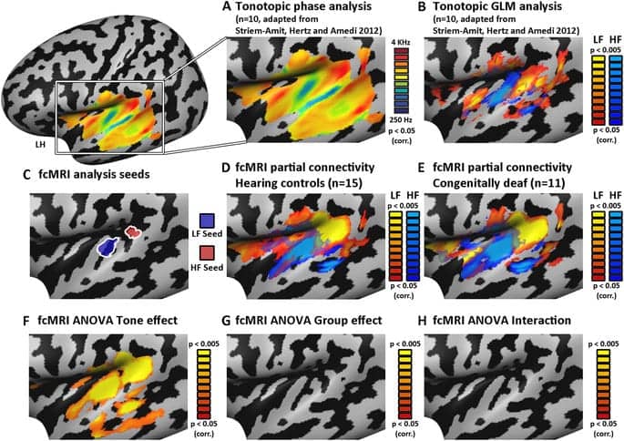 Auditory Cortex mapping