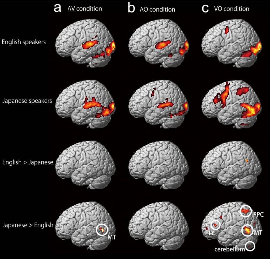 Neuroimaging from Japanese study