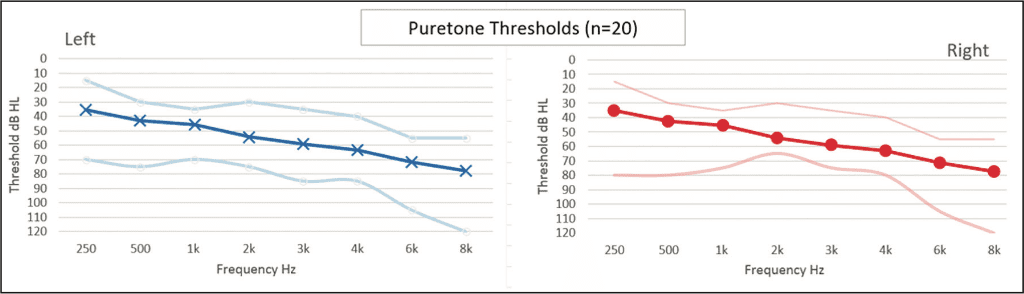 Figure 1. Average audiometric thresholds (left and right ears) for 20 listeners with hearing loss who participated in this study. Minimum and maximum thresholds are also shown as lower and upper boundaries (thinner lines).