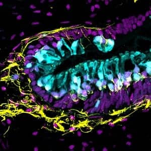 Human inner ear organoid with sensory hair cells (cyan) and sensory neurons (yellow). An antibody for the protein CTBP2 reveals cell nuclei as well as synapses between hair cells and neurons (magenta).