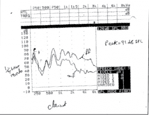 Figure 1. Spectral analysis (using REM) of a clarinet playing middle C, with the playing level of the clarinet at mezzo forte (mf) and fortissimo (ff).