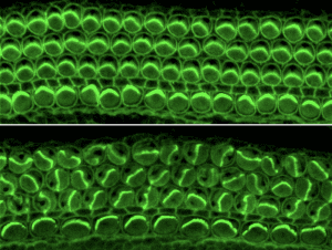 Inner-ear filaments bundled, facing the same direction (top image). Bundles without the Daple protein that appear scrambled (bottom image).