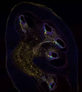 Human cochlea at 10 weeks of development immunostained for markers to identify hair cell progenitors: “CD271” in yellow, “p27“ in green. © Marta Roccio and Michael Perny, Inner Ear Research Laboratory, Department for BioMedical Research (DBMR), University of Bern.