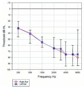 Figure 1. Average air conduction thresholds from the six participants in this study. Ranges are shown by error bars.