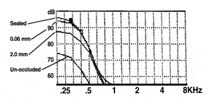 f02-fig02.gif (18393 bytes)