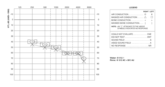 Tuning Forks Revisited Theory Use And Interpretation Of Results