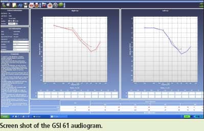 screen shot of GSI 61 audiogram