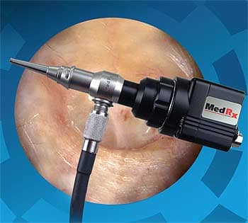 MedRx Video otoscope