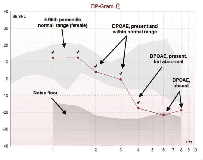 BeckFig1 opt