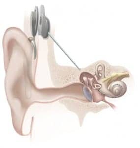 'The Brain Channel' Program on UCTV Features Hearing Researchers
