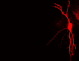 A neuron in the brain stem, that processes acoustic information. Depending on the situation, the cell generates action potentials in the axon (thin process) either close to or far from the body. Photo: Felix Felmy.
