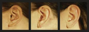 Researchers from Bielefeld University in Germany have demonstrated the origin of the mapping between auditory pitch and spatial elevation. Their analysis suggests that the shape of the human ear might have evolved to mirror the acoustic properties of the natural environment. Photo: Cesare & Ernst