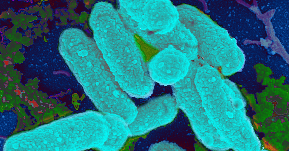 Scientists Find Link Between Antibiotics and Bacterial Biofilm
