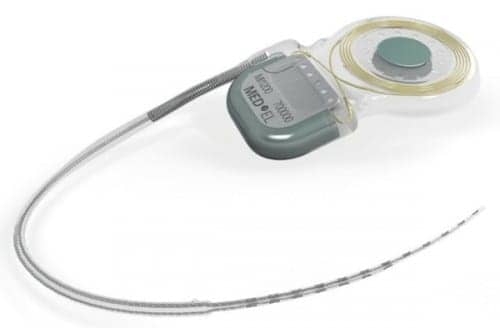MED-EL's Synchrony CI Implanted in First US Patient