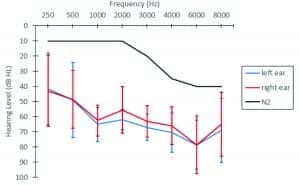 Figure 1. The black line shows an N2 hearing loss11 which was the simulated hearing loss for the normal hearing group. Blue and red lines reflect the mean audiogram (±1 SD) for left and right ears, respectively, for the hearing-impaired group.