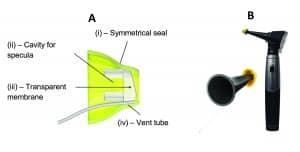 Figure 2a-b. Left: Anatomy of the EVOB showing: (i) Symmetrical seal; (ii) Hollow cavity for the specula; (iii) Transparent membrane (angled to prevent reflection), and (iv) Hollow vent tube. Right: Placement of EVOB on otoscope prior to insertion into the ear.