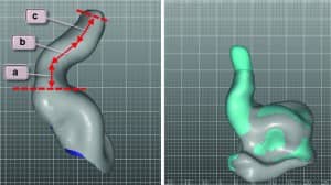 Figure 4a-b. Left: Technique for measuring the absolute canal length in the current study. a + b + c = canal absolute canal length with standard otoblock. Right: Align and compare of impression taken with the standard otoblock (grey) and the EVOB (light blue). In this case, the EVOB has enabled an additional 7 mm canal depth. (Note: grid lines are 1 mm.)