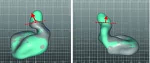 Figure 7a-b. Alignment and comparison of ear impressions taken with a standard otoblock (grey) and EVOB (light blue). These two examples illustrate how the extra information provided by the EVOB enable more accurate placement of the sound bore following the path towards the ear drum.