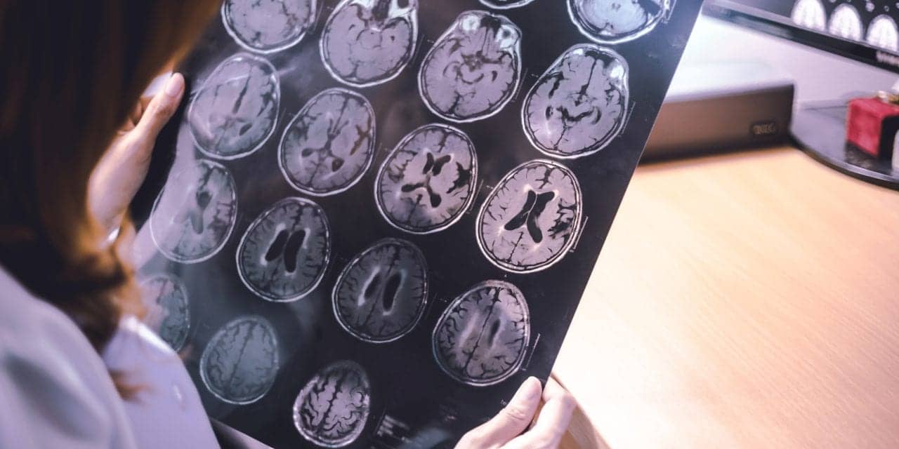 Researchers Find Link Between Alzheimer's Disease and Disrupted Sleep