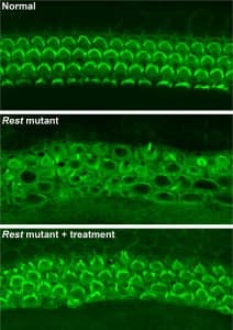 Top: Rows of healthy sensory hair cells in the mouse inner ear with green stereocilia arcs. Middle: In Rest mutant mice, hair cells are disorganized, and stereocilia barely visible. Bottom: In Rest mutant mice treated with HDAC inhibitors, organization and structure of hair cells is partially restored.Yoko Nakano, Carver College of Medicine, University of Iowa, Originally published in Cell.