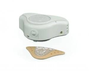 Figure 1. The ADHEAR System is indicated for people with conductive hearing loss. Designed to be an ideal solution for people who cannot or do not want to undergo surgery or for people suffering from conductive hearing loss of uncertain duration, the system consists of an adhesive adapter that resembles what some might describe as a high-tech “sticker” containing a place for the audio processor to click onto.