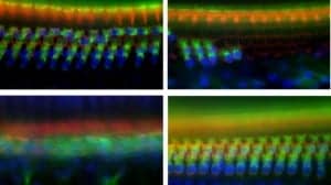Upper left: Inner hair cells (orange row at top) and outer hair cells (blue/green array at bottom) in the cochlea of mice lacking the Tmtc4 gene, 10 days after birth. Upper right: Substantial decrease, through cell death, of both types of hair cells, 30 days after birth. Bottom left: 45 days after birth, no hair cells remain. Bottom right: For comparison, outer hair cells in a normal mouse 30 days after birth. Credit: Sherr and Chan labs/UCSF.