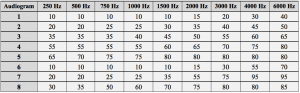Table 3. Eight audiometric configurations as established using the IEC 60118-5 measurement procedure.37 All data points are in dB HL.