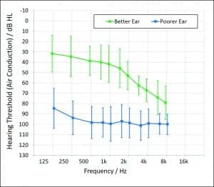 Figure 1. Mean air conduction hearing thresholds of the study participants, in dB HL. Results for the good and poor ears are shown in green and blue, respectively. The error bars represent ±1 standard deviation.