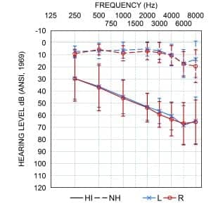 Figure 2. Average audiograms of hearing-impaired (solid lines) and normal hearing listeners (dashed lines) tested in the current study. Error bars represent ±1 SD of the mean.