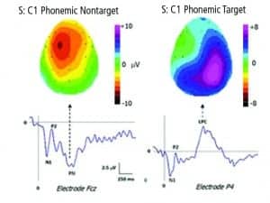 Figure 1. Topographic maps of a single listener in a phonemic detection experiment, contrasting the negative surface activity of non-target words with the positive surface activity of the target words. The two maps differ according to both polarity of the response and its locus over the surface of the skull.
