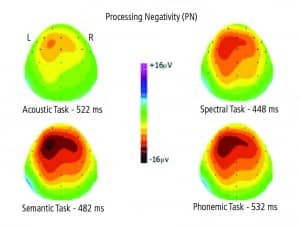 Figure 3. Topographic maps of the distribution of AERP voltages across the surface of the skull for each of the four conditions of the experiment. Warm colors denote negativity, cold colors positivity. PN negativity is maximal over the left fronto-central areas in each condition. PN negativity is smallest in the noise-burst condition, intermediate for the spectral condition, and greatest for the phonemic and semantic conditions.