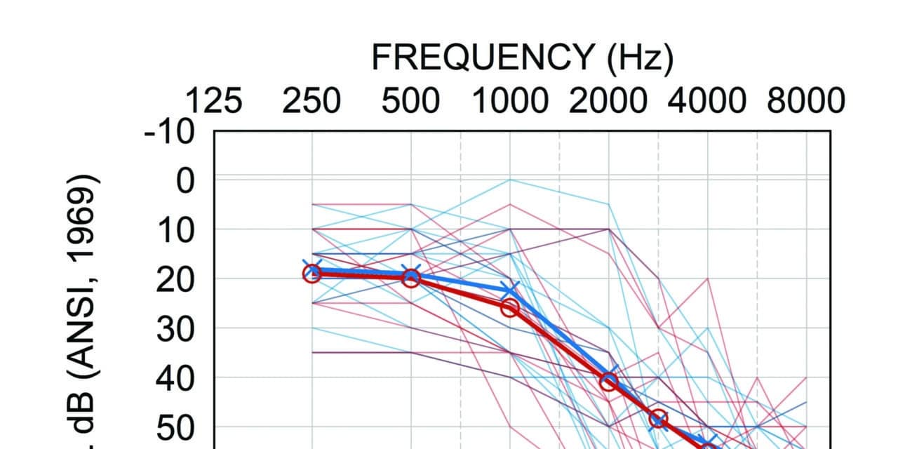 Neural Encoding of the Stimulus Envelope Facilitated by Widex ZeroDelay